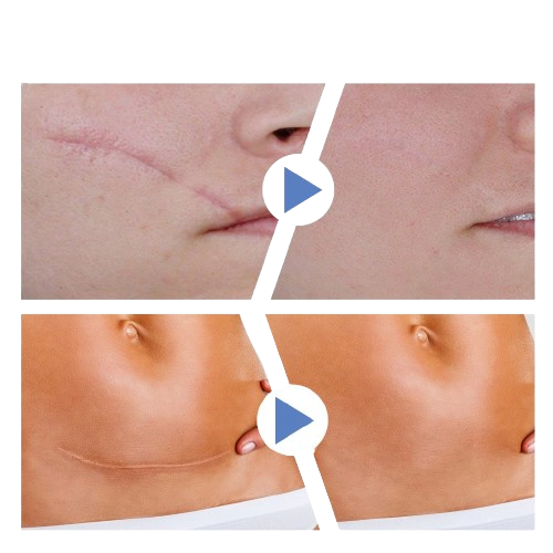 gid://shopify/MediaImage/40581402951898